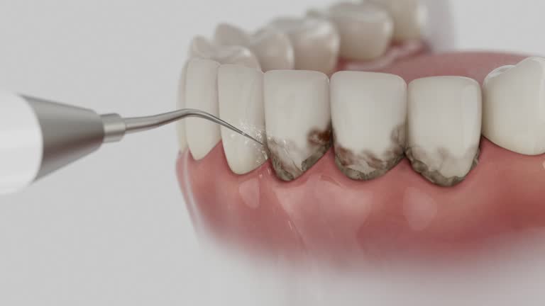Reliable Dental contractor in Middletown, VA by Smile Center Dentistry